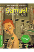 Samuel un monstre dans la peau