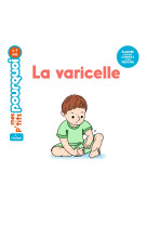 La varicelle